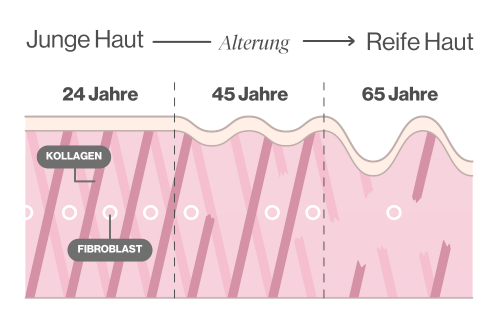 Hautalterung