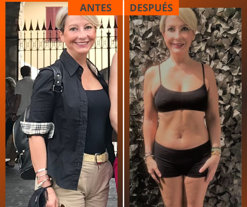 Las fotos de antes y despúes de Elvina