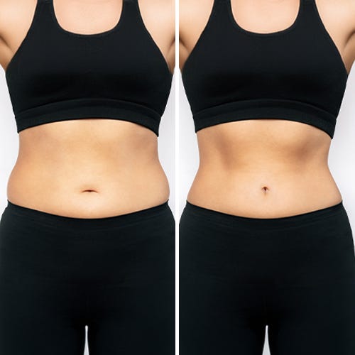 Toned stomach