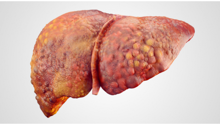 Liver